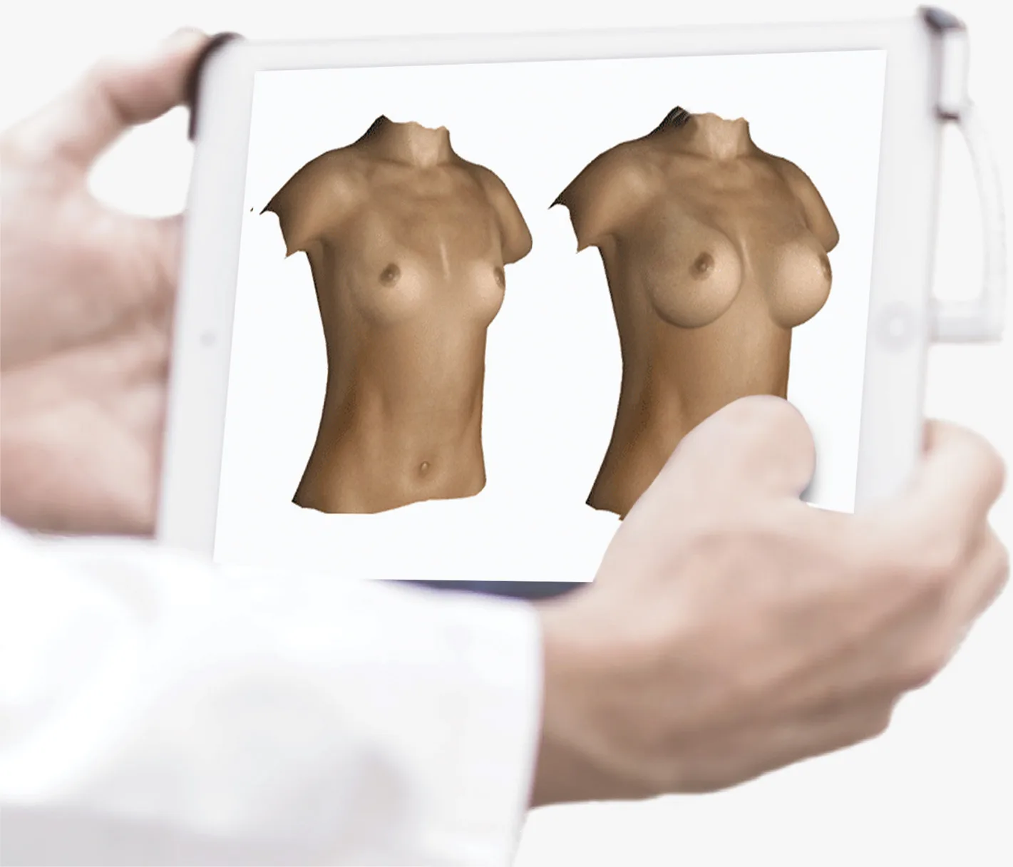 3D before / after breast simulation, shown on a tablet during the consultation
