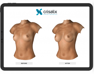Crisalix breasts on iPad